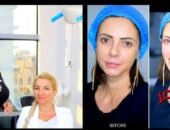 الدكتورة إسراء رسول تكشف حقائق عمليات تجميل الوجه الزائدة وفوائد الفيلر والبوتوكس